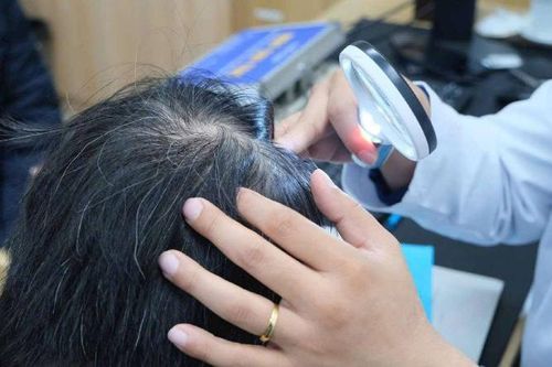Bạc tóc ở tuổi 20, có nguy hiểm?