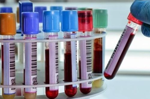 Phát hiện nguyên nhân bí ẩn khiến một bệnh nhi bị chẩn đoán nhầm là viêm tụy cấp