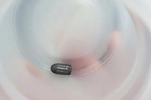 Xác định đối tượng bắn 'đạn lạc' trúng đầu người phụ nữ
