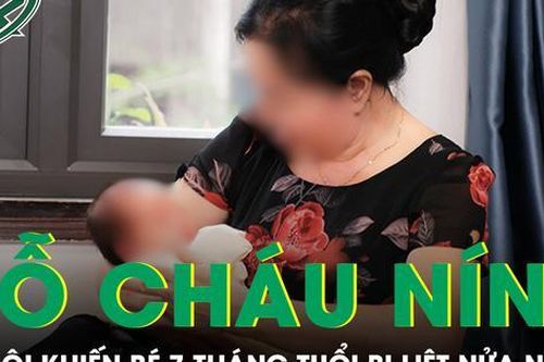 Bé 7 tháng tuổi liệt nửa người vì sai lầm của bà nội trong lúc dỗ cháu nín khóc