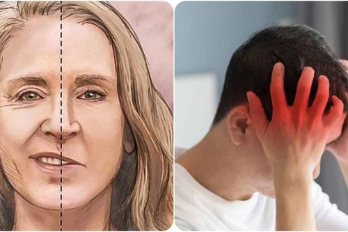 7 triệu chứng sắp bị đột quỵ cần lưu ý và xử lý ngay