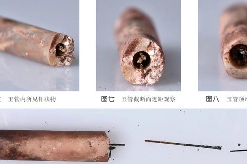 Bất ngờ phát hiện kim châm cứu bằng thép cổ nhất thế giới