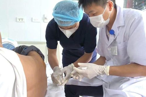 Rủ nhau đi khám vì đau đầu, ba người được bác sĩ chẩn đoán nhiễm giun não vì thói quen không ngờ