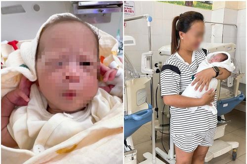 Giành giật sự sống cho bé gái sinh non bị suy hô hấp từ người mẹ mắc hội chứng HELLP