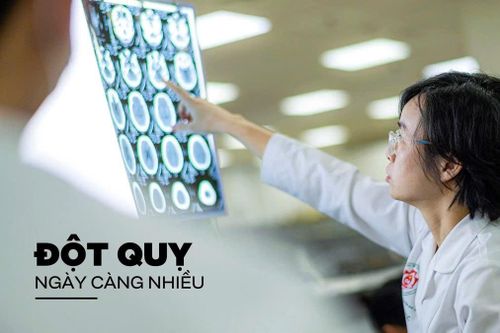 Vì sao đột quỵ ngày càng nhiều?