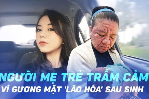 Người mẹ trẻ trầm cảm vì gương mặt 'lão hóa' sau sinh, biến đổi đến mức không nhận ra