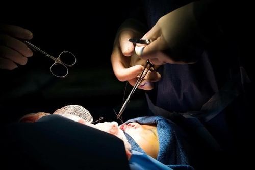 Phẫu thuật sứt môi, hở hàm ếch miễn phí cho trẻ em