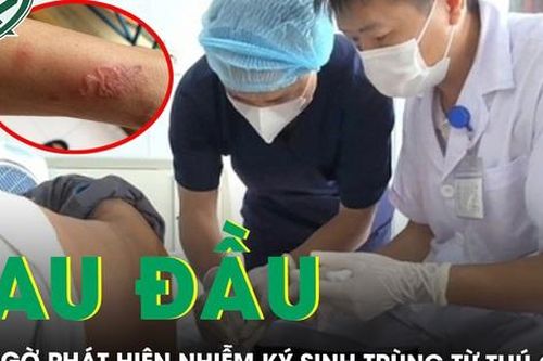 Rủ nhau đi khám vì đau đầu bất ngờ phát hiện nhiễm ký sinh trùng từ thú cưng
