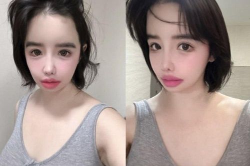 Park Bom dừng hoạt động