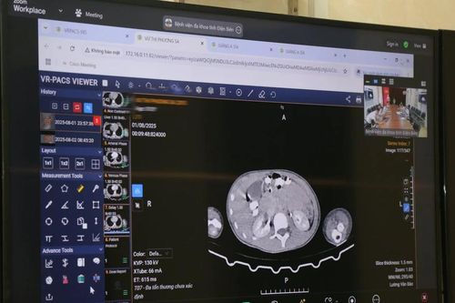 4 nạn nhân trong vụ lũ quét tại Điện Biên được Telemedicine hội chẩn cấp cứu
