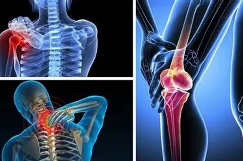 Đại học Bách khoa Hà Nội nghiên cứu nghiên cứu và phát triển thành công loại polymer hỗ trợ phục hồi cơ xương khớp