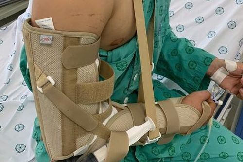 Chơi vật tay với bạn, thanh niên 18 tuổi ở Hà Nội bị gãy xương