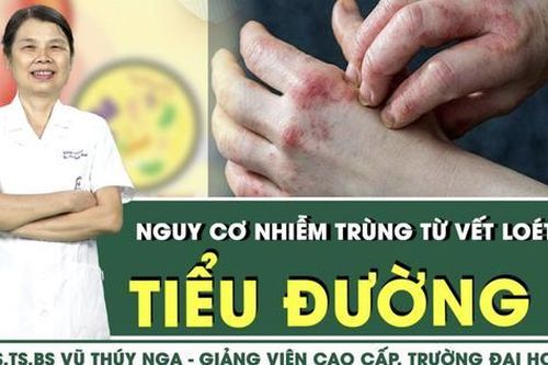 Nguy cơ nhiễm trùng cao từ vết thương nhỏ ở người bệnh tiểu đường