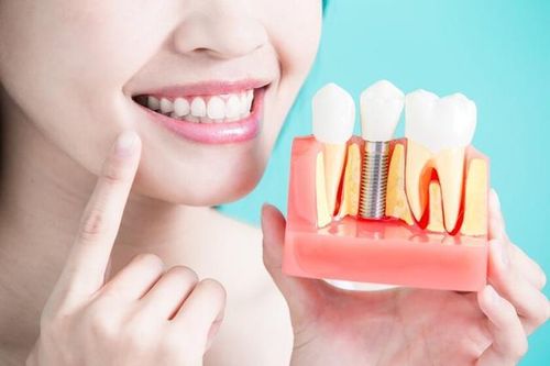 Chăm sóc nướu sau implant: Bảo vệ răng từ gốc