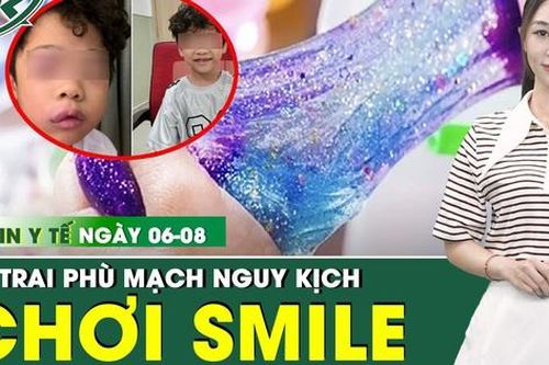Bản tin Y tế 6/8: Bé trai phù mạch nguy kịch sau 30 phút chơi slime