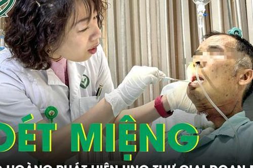 Chủ quan với vết loét miệng, người đàn ông bàng hoàng nhận kết quả ung thư giai đoạn muộn