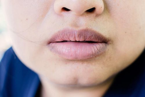 Dấu hiệu phổi chứa nhiều độc tố biểu hiện ngay trên mặt