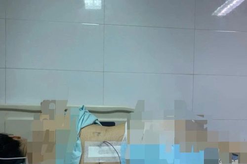 Khởi tố vụ cô gái mất 96% sức khỏe vì bị khung đỡ đèn tiệc cưới đổ sập, đè lên người