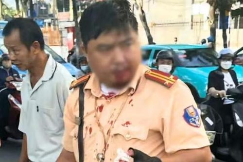CSGT bị người đàn ông ngoại quốc đấm chảy máu khi đang làm nhiệm vụ