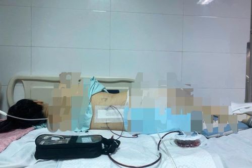 Công an khởi tố vụ cô gái bị đèn đám cưới rơi gây thương tật 96%