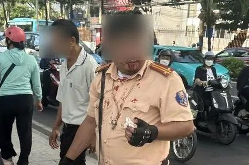 Tạm giữ hình sự người nước ngoài tấn công cán bộ CSGT ở Khánh Hòa