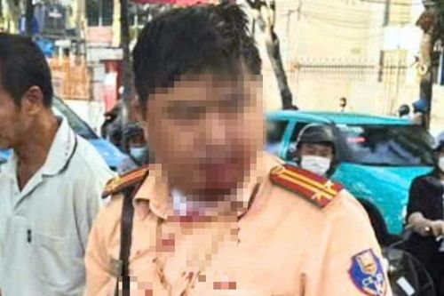 Thanh niên người Nga đấm vào mặt Trung tá CSGT ở Nha Trang bị tạm giữ hình sự