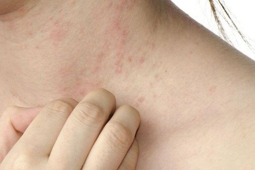 Vàng da, béo bụng, ngứa dai dẳng... có thể là dấu hiệu gan đang 'cầu cứu', đừng chủ quan mà bỏ qua 6 thay đổi này trên cơ thể
