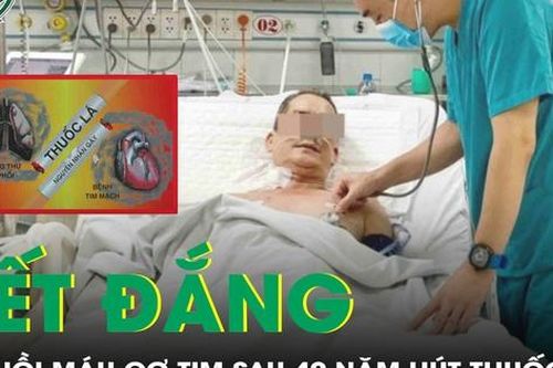 40 năm hút thuốc lá, người đàn ông bị nhồi máu cơ tim nguy kịch