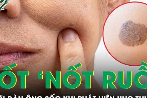 Liên tục đốt 'nốt ruồi' không hết, người đàn ông trẻ sốc khi phát hiện mắc ung thư da