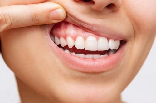 Ăn uống đồ quá nóng, quá lạnh: Kẻ thù âm thầm của răng và nướu (lợi)
