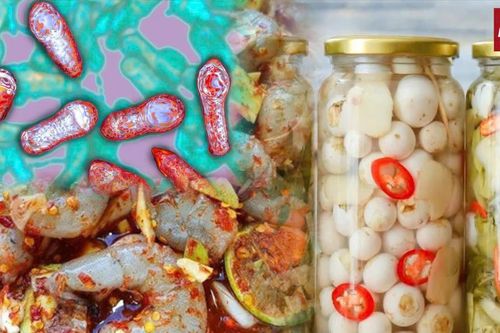 Ngộ độc Botulinum: 'Món ăn của ký ức' trở thành cơn ác mộng chết người