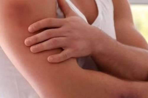 9 triệu chứng của gan nhiễm mỡ dễ thấy nhất trên da