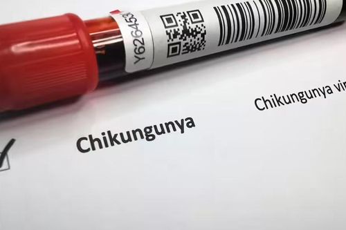 Bệnh chikungunya dễ bị chẩn đoán sai và khó xác định số người nhiễm bệnh