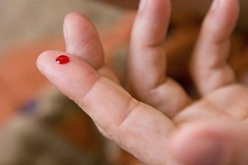 Tin lời mạng xã hội 'chích máu đầu ngón tay cứu đột quỵ', nhiều người vô tình đẩy bệnh nhân vào nguy kịch, bác sĩ cảnh báo sai lầm chết người này
