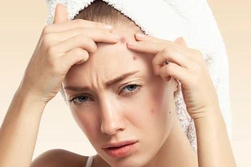 6 món ăn khiến mụn bùng phát và bí quyết ăn uống để 'cứu' làn da