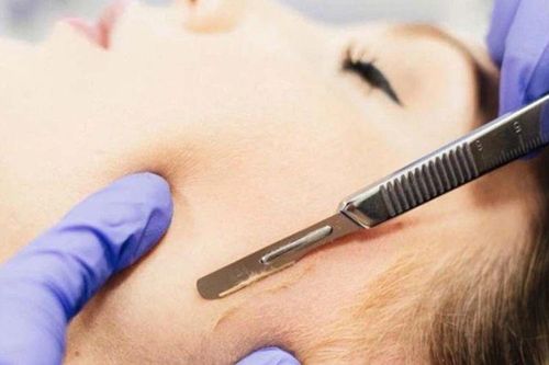 Bác sĩ chỉ cách cạo lông mặt không bị mụn, da mịn như em bé