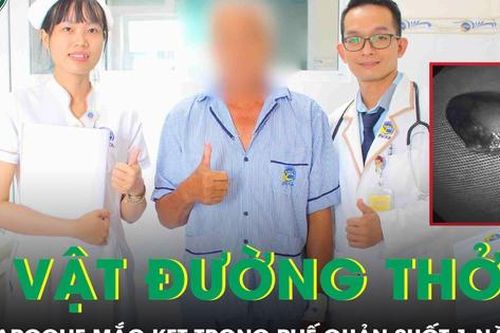 Tưởng mắc bệnh hô hấp mãn tính, không ngờ phát hiện hạt hồng xiêm kẹt trong phế quản