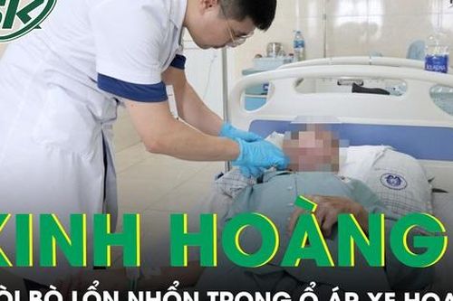 Kinh hoàng dòi bò lổn nhổn trong ổ áp xe hoại tử