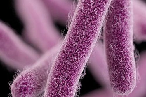 Pháp thu hồi phô mai mềm sau 2 ca tử vong nghi nhiễm khuẩn listeria