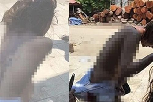 Truy tố nhóm đánh ghen nhầm gây thương tích 26% cho người khác