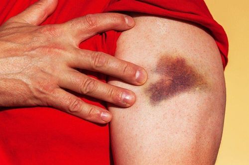 8 dấu hiệu cơ thể đang tụt phong độ, nam giới nên chú ý