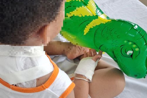 Bé trai 4 tuổi bị chó becgie của nhà cắn vào cổ và lưng