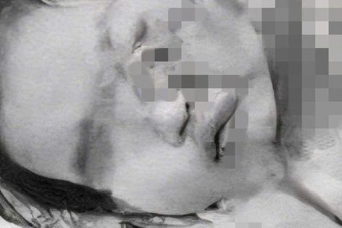 Mẹ vừa xuống xe, bé gái 2 tuổi vô tình vặn ga khiến xe lao thẳng vào hàng rào sắt, nhập viện trong tình trạng đa chấn thương