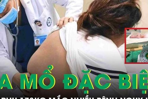 60 phút 'cân não' mổ lấy thai cho sản phụ 178 kg không thể gây mê vì lớp mỡ quá dày