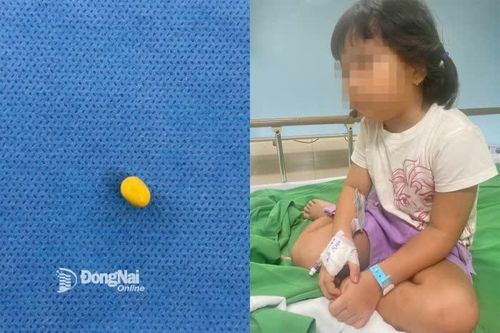 Suýt thủng màng nhĩ do bị nhét sỏi vào tai khi đi chơi