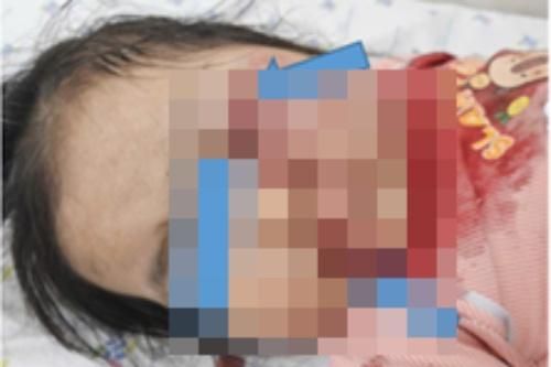 Một giây sơ suất, bé gái ngồi trước xe máy phải đi cấp cứu