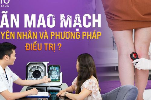 Giãn mao mạch: Nguyên nhân và phương pháp điều trị?
