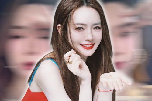 Nữ diễn viên thừa nhận khuôn mặt bị biến dạng vì tiêm botox, diện mạo cứng đờ khó nhận ra