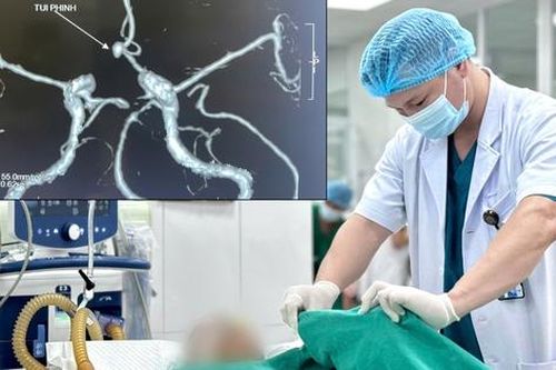 Vi phẫu 'thần tốc' cứu sống bệnh nhân vỡ phình động mạch não