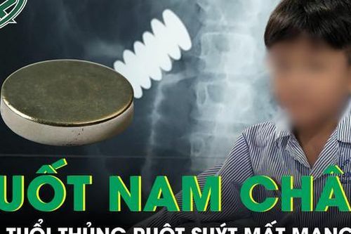 Nuốt 4 viên nam châm, bé trai 6 tuổi ở Cần Thơ thủng ruột, suýt mất mạng